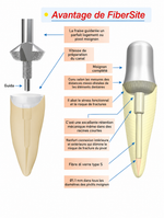 FiberSite Post
